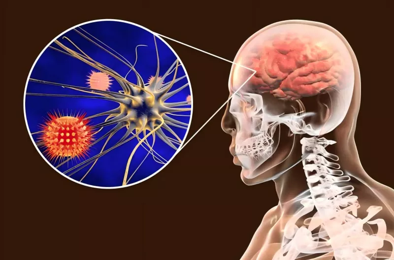 Treoir maidir le Vacsaín Meningococcal